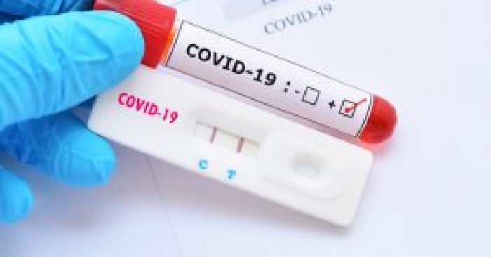 Juazeiro registra 15 novos casos da Covid-19 nesta sexta-feira