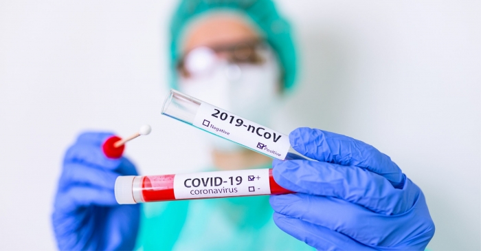 Juazeiro registra 168 novos casos da Covid-19 nesta sexta-feira