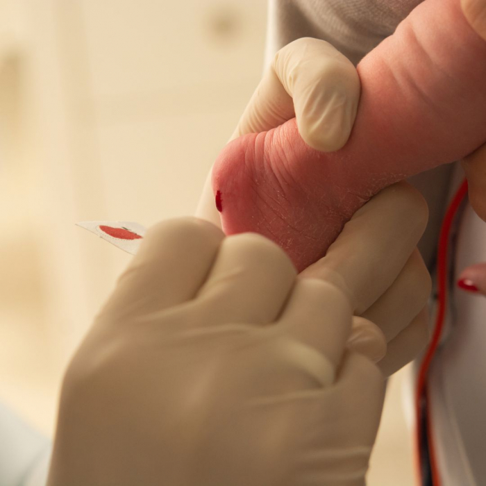 “O teste do pezinho permite o diagnóstico precoce de doenças”, alerta pediatra 